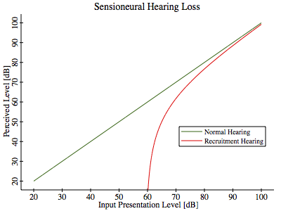 Sensioneural Hearing Loss